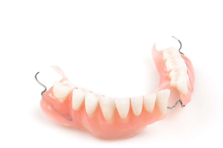 acrylic lower partial denture with wire clasps
