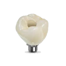 Screw-retained crown over implant